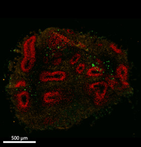 Bild: Urania und Berlin Brains on Tour: Plastik im Kopf